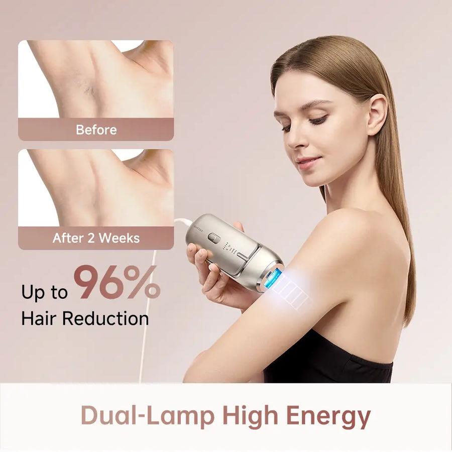 HAIR REMOVAL DEVICE IPL NOVA/AHR01-GOLD DREAME - Image 4
